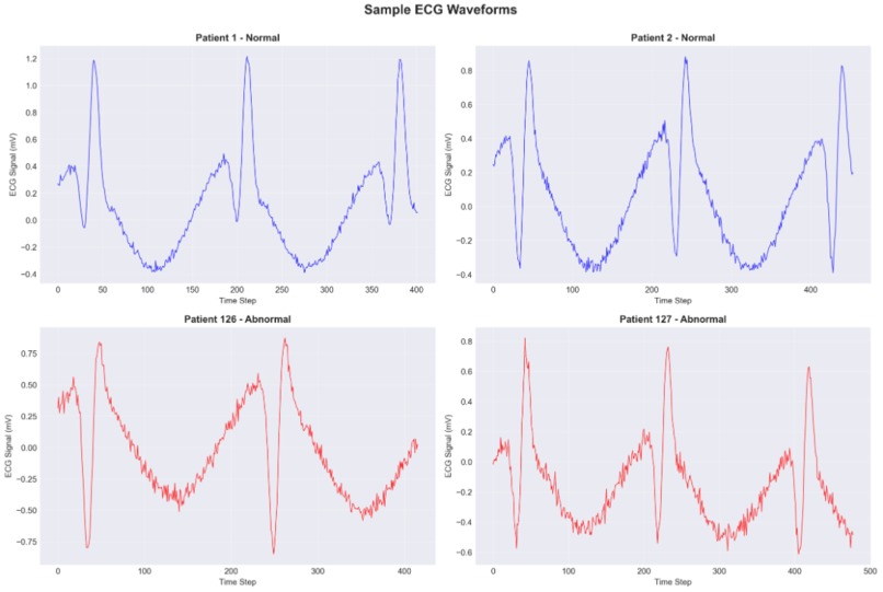VitaBeat – screenshot 6