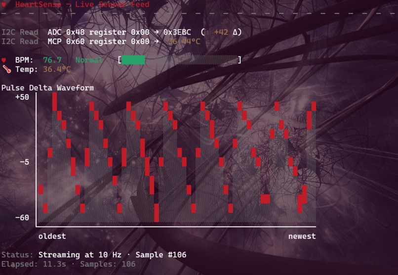 HeartSense – screenshot 1