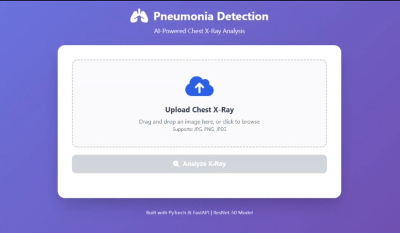 Pneumonia.AI  – screenshot 1