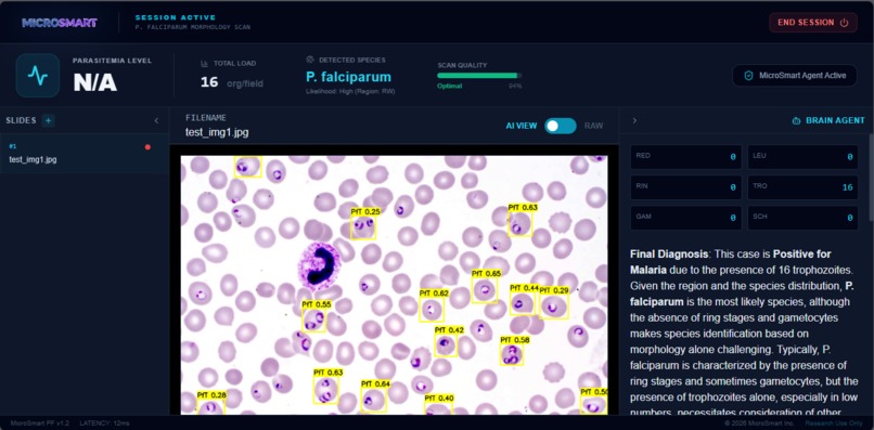 MicroSmart – screenshot 1