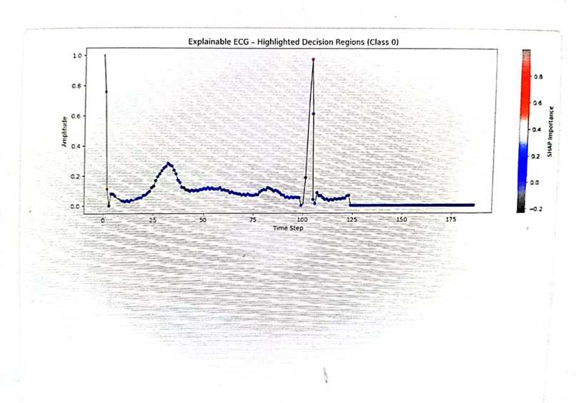 Explainable-ECG: Trustworthy AI for Arrhythmia Detection – screenshot 4