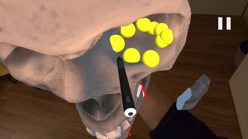 SurgiPlanXR – screenshot 4