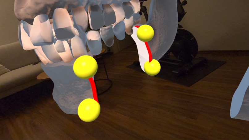 SurgiPlanXR – screenshot 6