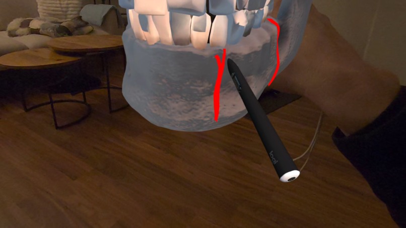SurgiPlanXR – screenshot 8