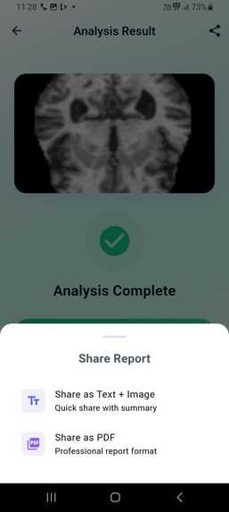 AI 4 Alzheimers – screenshot 5