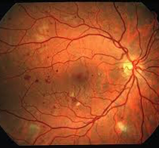 RetinaScan – screenshot 1