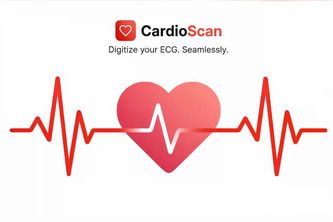 CardioScan: ECG Digitization with ResNet-UNet 