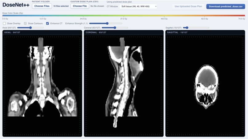 DoseNet++ – screenshot 1
