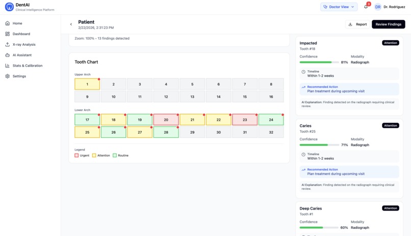 Dent-AI – screenshot 10