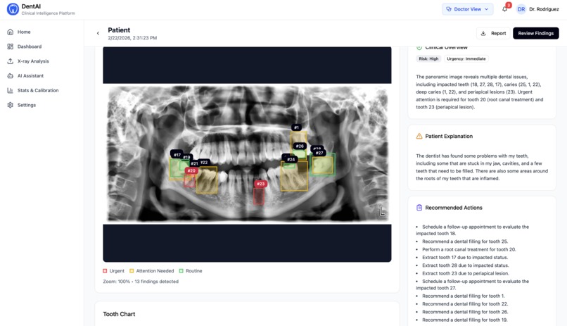 Dent-AI – screenshot 16