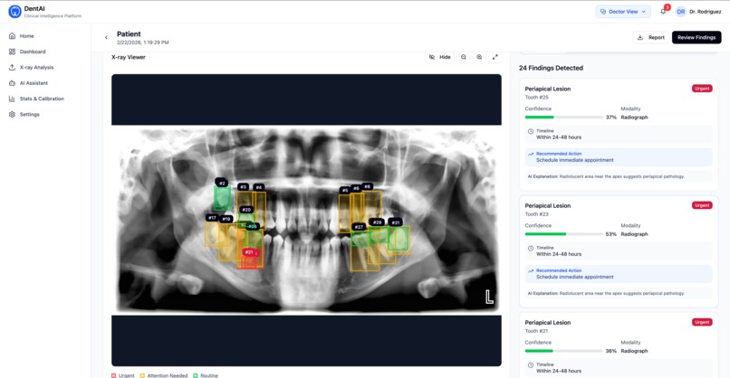 Dent-AI – screenshot 17