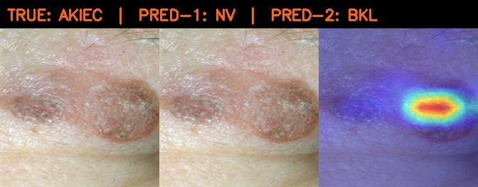 DermaTrace.ai – screenshot 1
