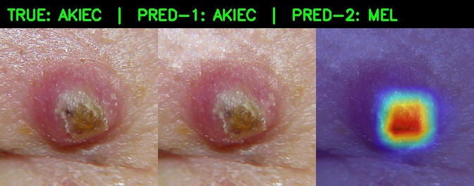 DermaTrace.ai – screenshot 2