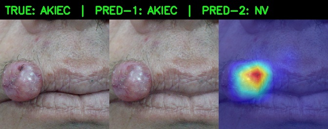 DermaTrace.ai – screenshot 3