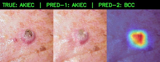 DermaTrace.ai – screenshot 4
