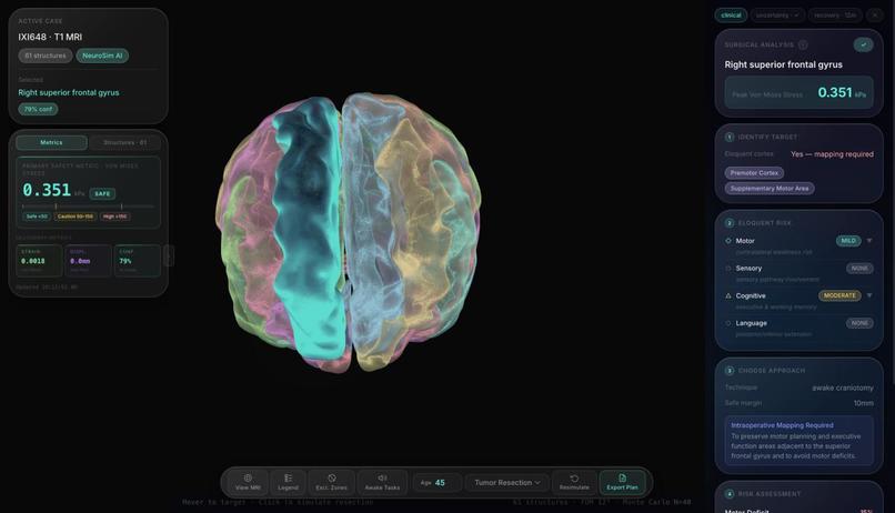 NeuroSim – screenshot 1