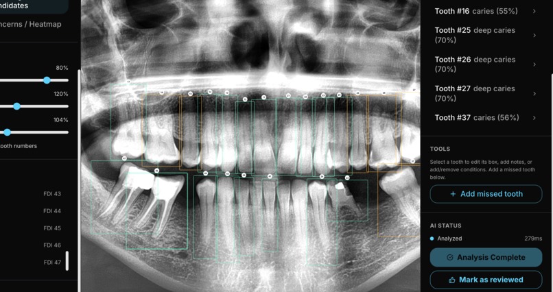 DentalAI – screenshot 1