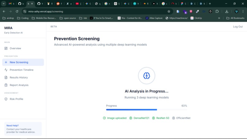 MIRA – screenshot 1