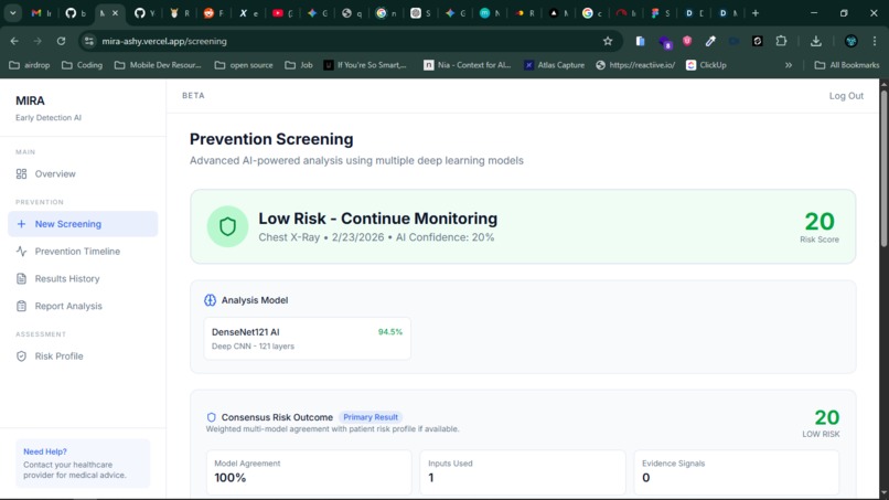 MIRA – screenshot 2