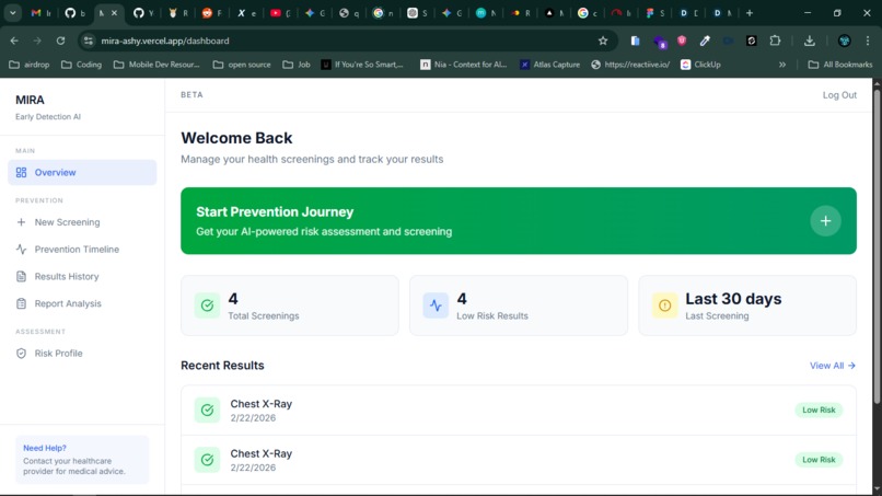 MIRA – screenshot 4