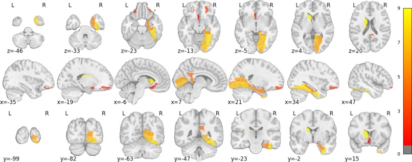 Clinical Safety Auditor: A Neuro-Symbolic Agentic Framework – screenshot 4
