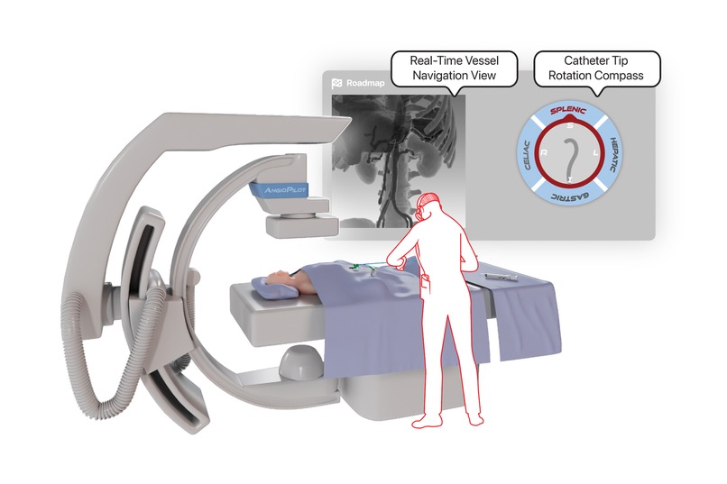 AngioPilot – screenshot 2
