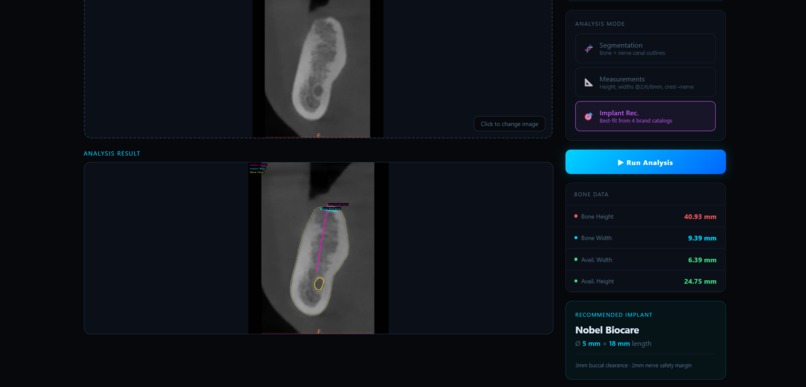 AI-Driven CBCT Implant Planning System – screenshot 7