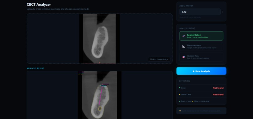 AI-Driven CBCT Implant Planning System – screenshot 8