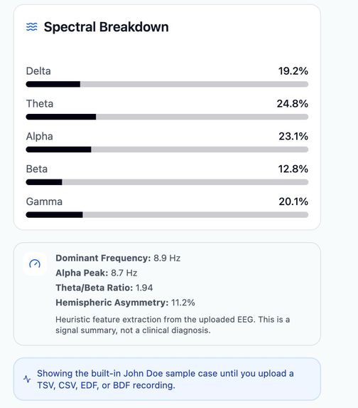EEG Hackathon – screenshot 2