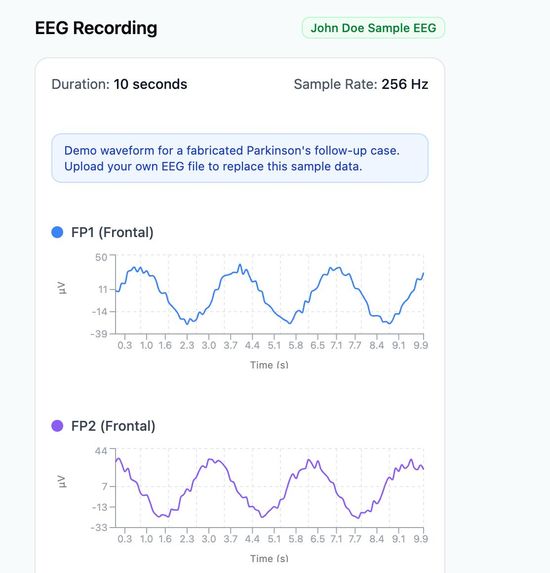 EEG Hackathon – screenshot 4