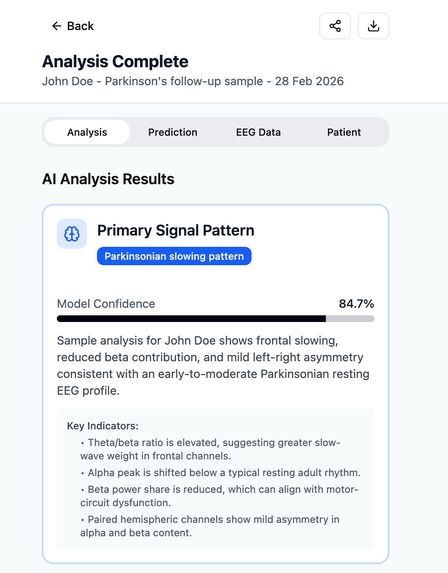 EEG Hackathon – screenshot 10