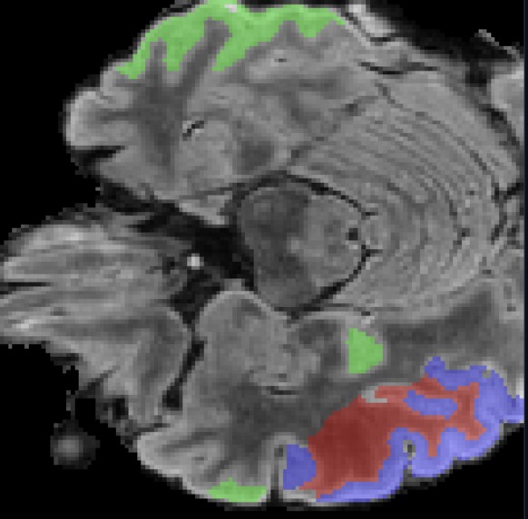 NeuroSight – screenshot 1