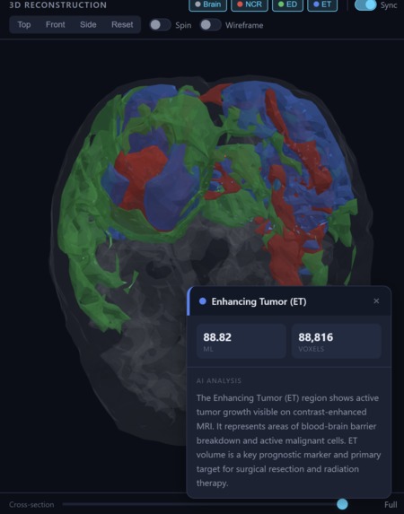 NeuroSight – screenshot 2