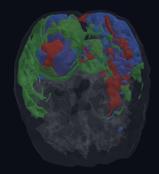 NeuroSight – screenshot 3
