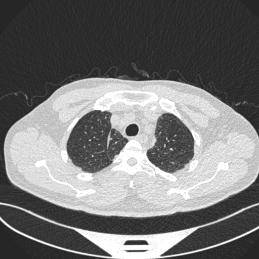 LungOC - Lung Cancer Risk Prediction System Analysis Tool – screenshot 1