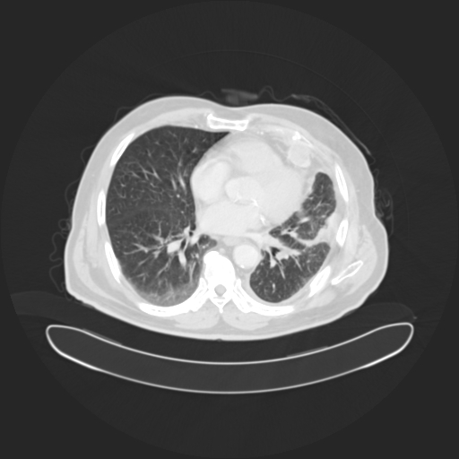 LungOC - Lung Cancer Risk Prediction System Analysis Tool – screenshot 2