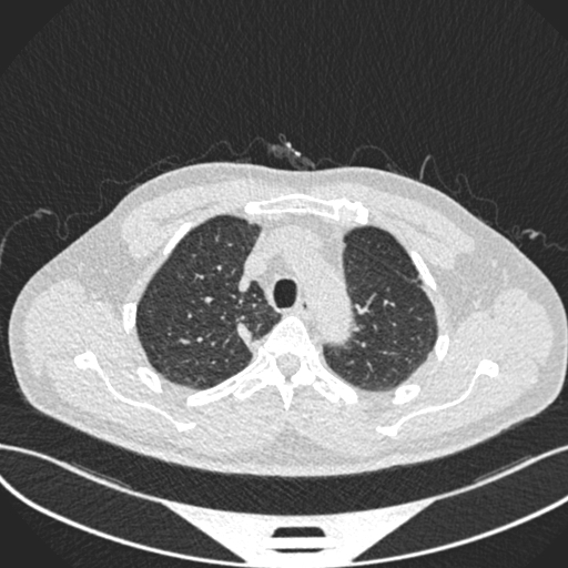 LungOC - Lung Cancer Risk Prediction System Analysis Tool – screenshot 3