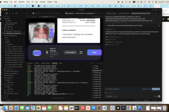 SpeedRay: Accelerating Chest X-Ray Diagnosis