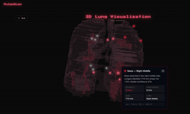 PulmoScan – screenshot 3