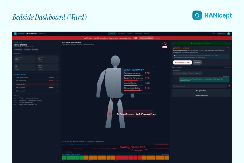NANIcept – screenshot 2