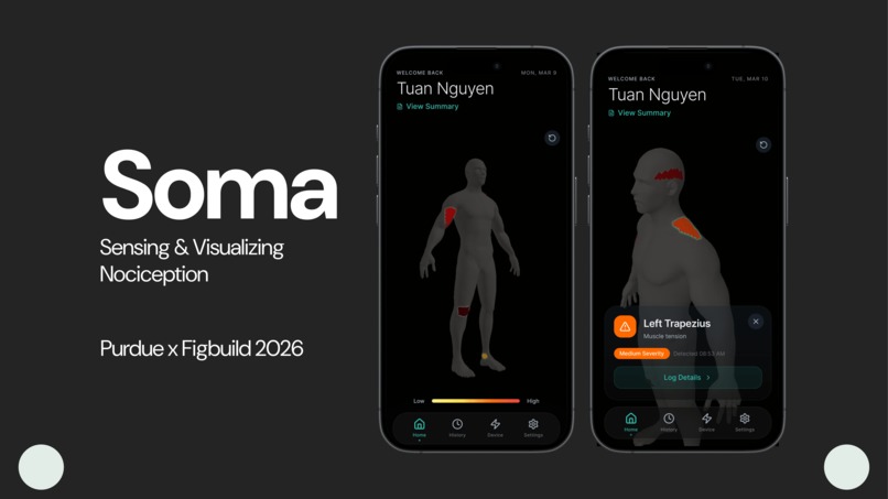 Soma – screenshot 1