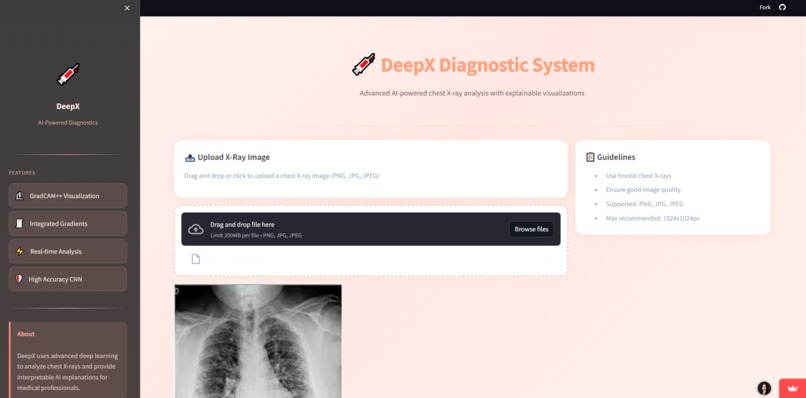 DeepX-ChestXRay – screenshot 1