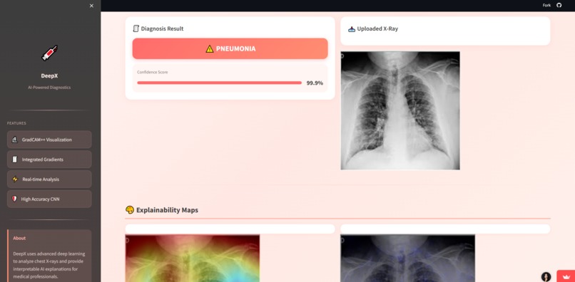DeepX-ChestXRay – screenshot 3