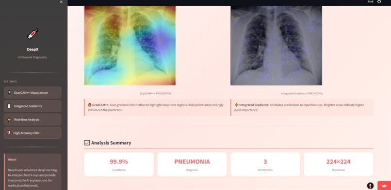 DeepX-ChestXRay – screenshot 2