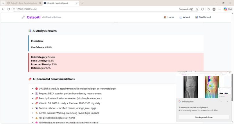 OsteoAI – AI Powered Osteoporosis Detection – screenshot 2