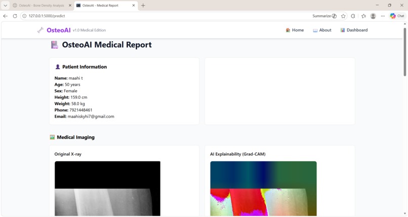 OsteoAI – AI Powered Osteoporosis Detection – screenshot 3