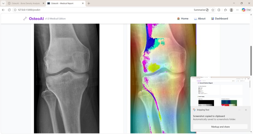 OsteoAI – AI Powered Osteoporosis Detection – screenshot 1
