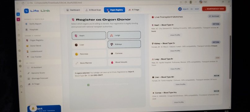 LifeLink(For Organ and blood donation ) – screenshot 2