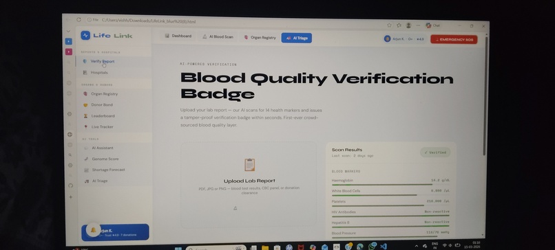 LifeLink(For Organ and blood donation ) – screenshot 4