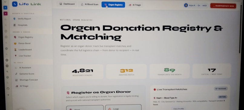 LifeLink(For Organ and blood donation ) – screenshot 6